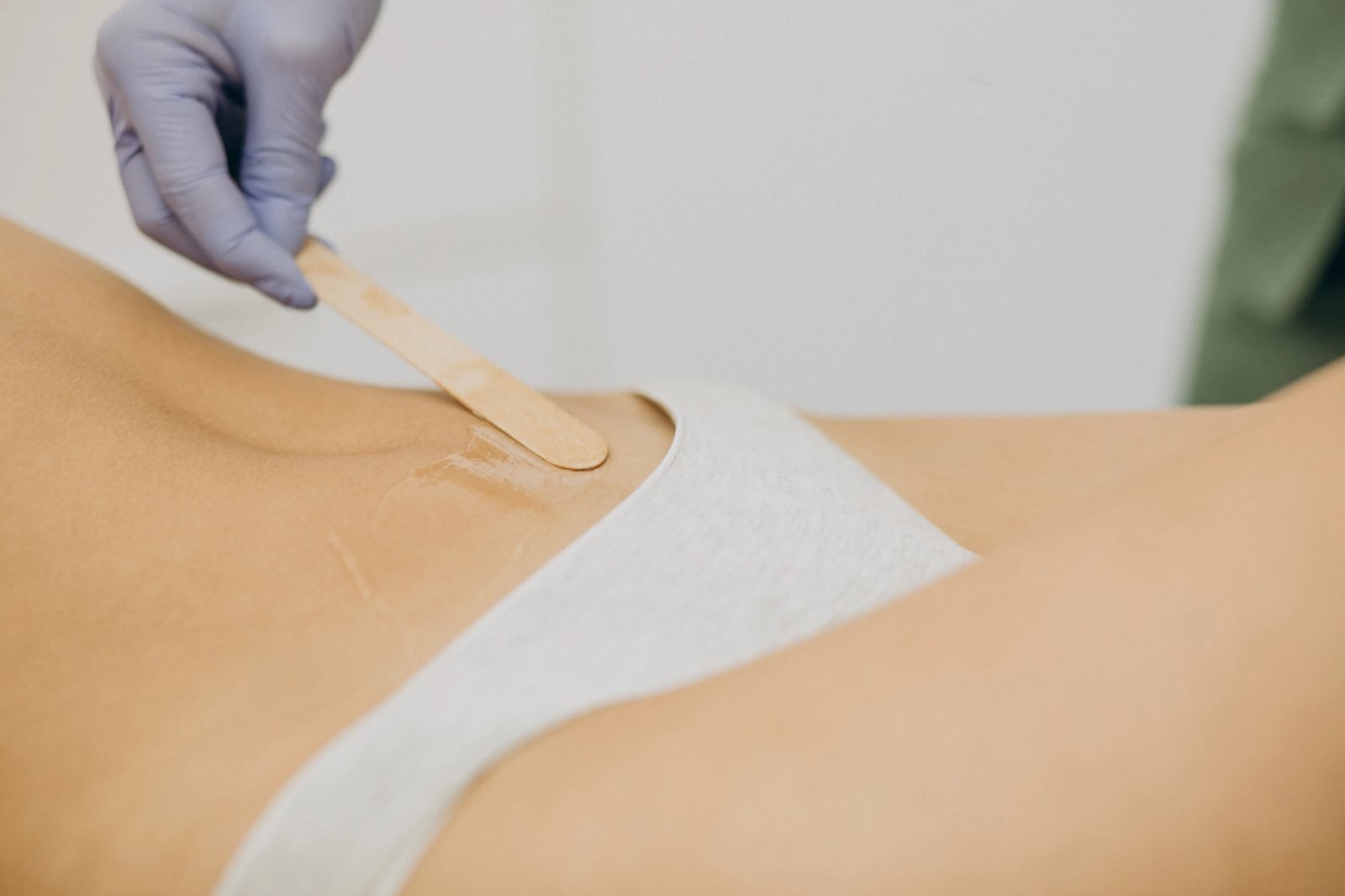 Laser epilation hair removal therapy