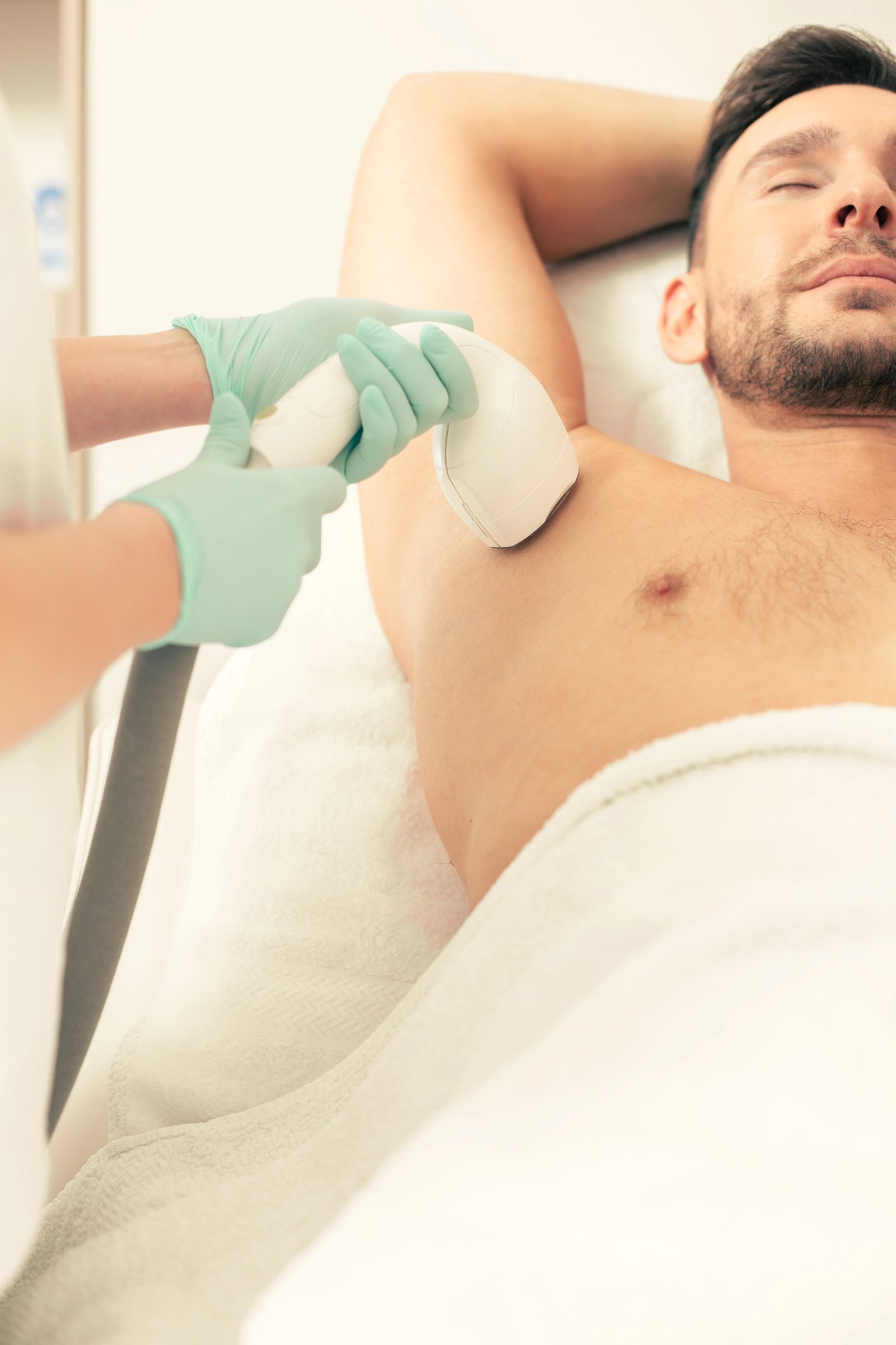 Laser hair removal treatment for men