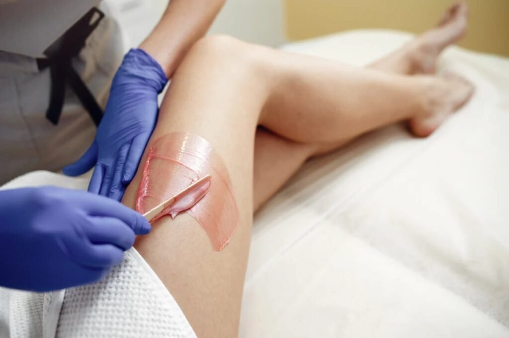 Candela laser hair removal treatment at Bare Beauty
