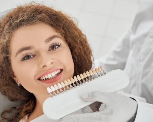 Professional teeth whitening results