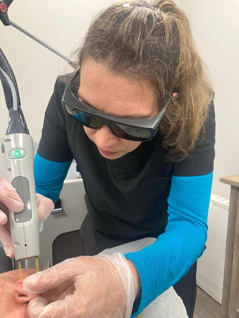 Vascular and redness laser treatment
